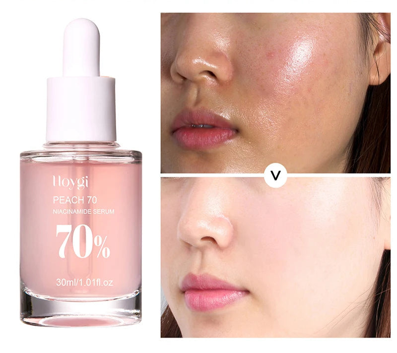 Peach 70% Niacinamide Serum 30ml Moisturizing Prevent Dryness Facial Essential Oil Increasing Elasticity Smooth Soften Skin Care