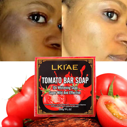 AILKE Organic Tomato Soap Bar, Lightening Skin, Deeply Clean, Exfoliate, Remove Dark Spots, Moisturizing, For Face and Body